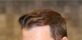 Haarverpflanzung in der Türkei: Gründe, Vorteile und Tipps Eine Haarverpflanzung in der Türkei hat viele Vorteile @www.haartransplantation-tuerkei.com